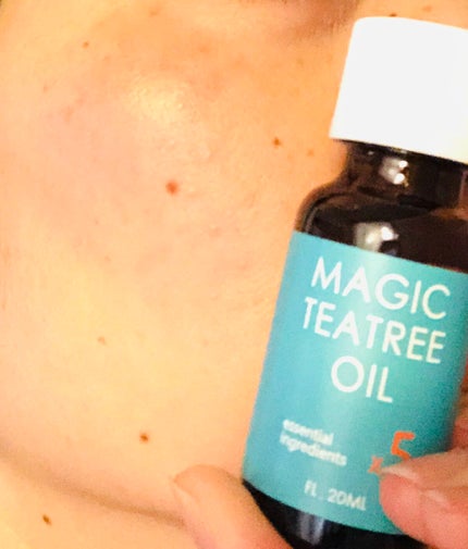 マジックティーツリーオイル/ブラン/フェイスオイルを使ったクチコミ(5枚目)