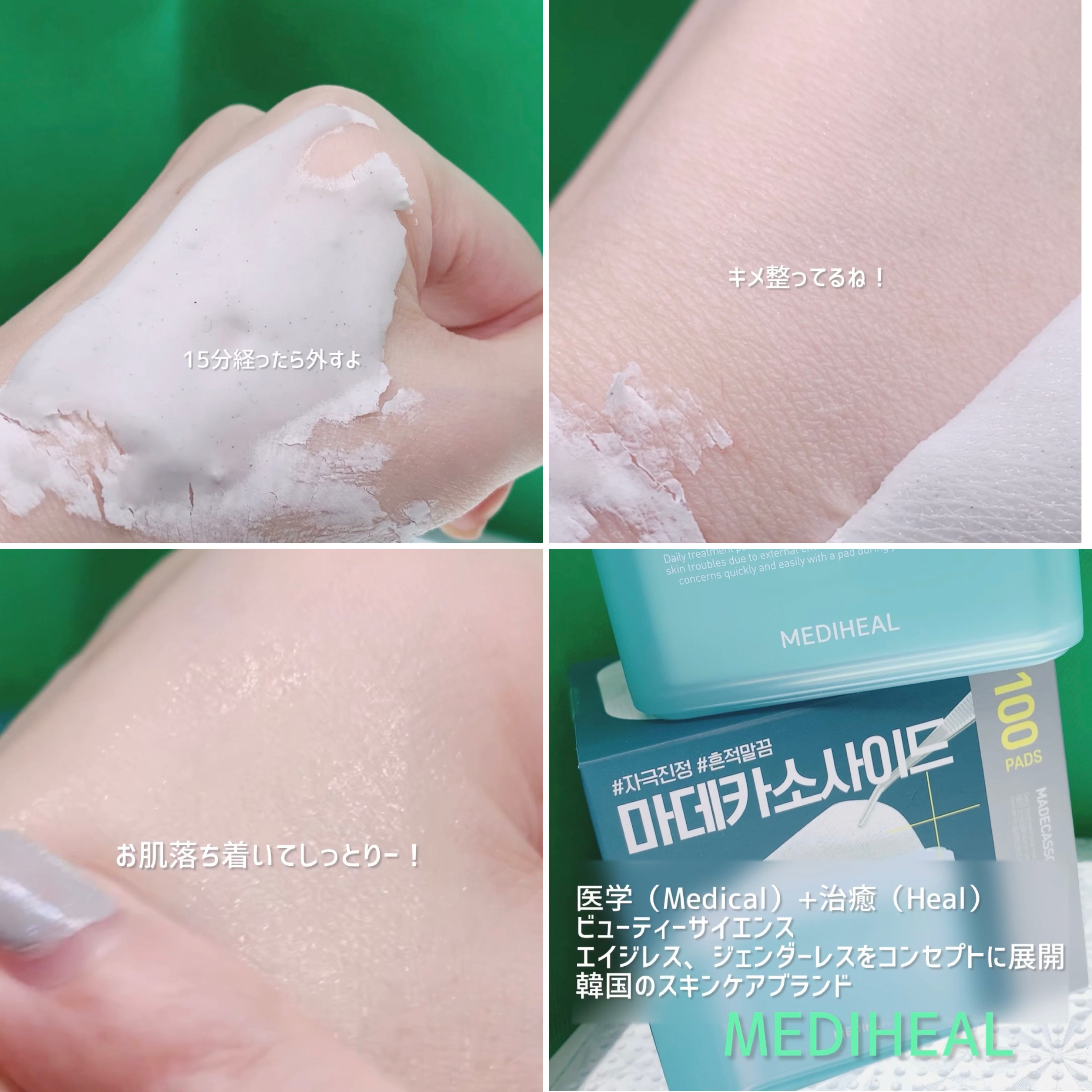 ダーマ モデリングパック マデカソサイドブレミッシュ/MEDIHEAL/シートマスク・パックを使ったクチコミ（3枚目）