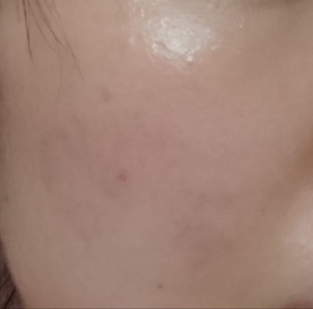 ポジティブソリューション/LUNASOL/美容液を使ったクチコミ(4枚目)