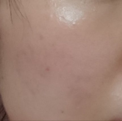 ポジティブソリューション/LUNASOL/美容液を使ったクチコミ(4枚目)