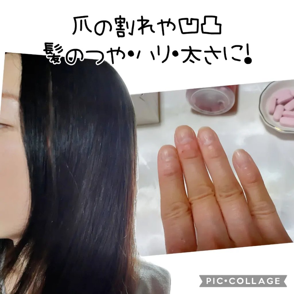 ビューティクル/メディタミン/美容サプリメントを使ったクチコミ（1枚目）