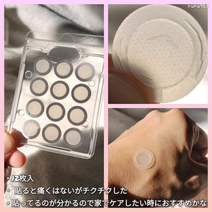 エーキュアショットスポットパッチ/obsero/にきびパッチを使ったクチコミ(2枚目)