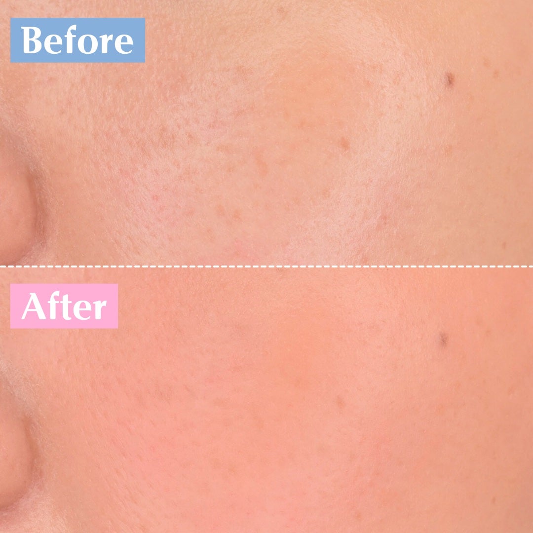 ムースケアチーク/nuse/リキッドチークを使ったクチコミ(8枚目)