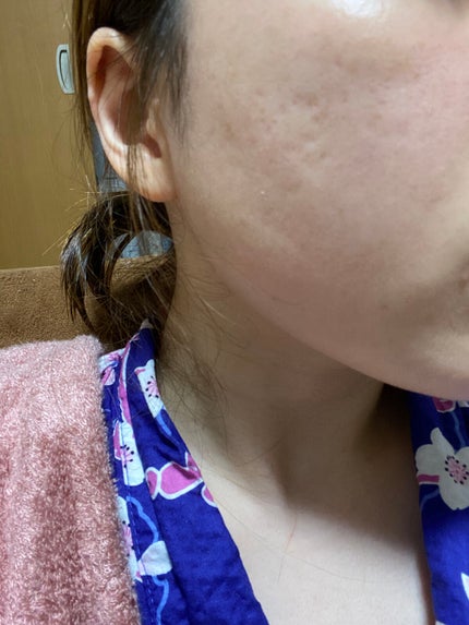 マリンに恋して/ラッシュ/その他洗顔料を使ったクチコミ(2枚目)