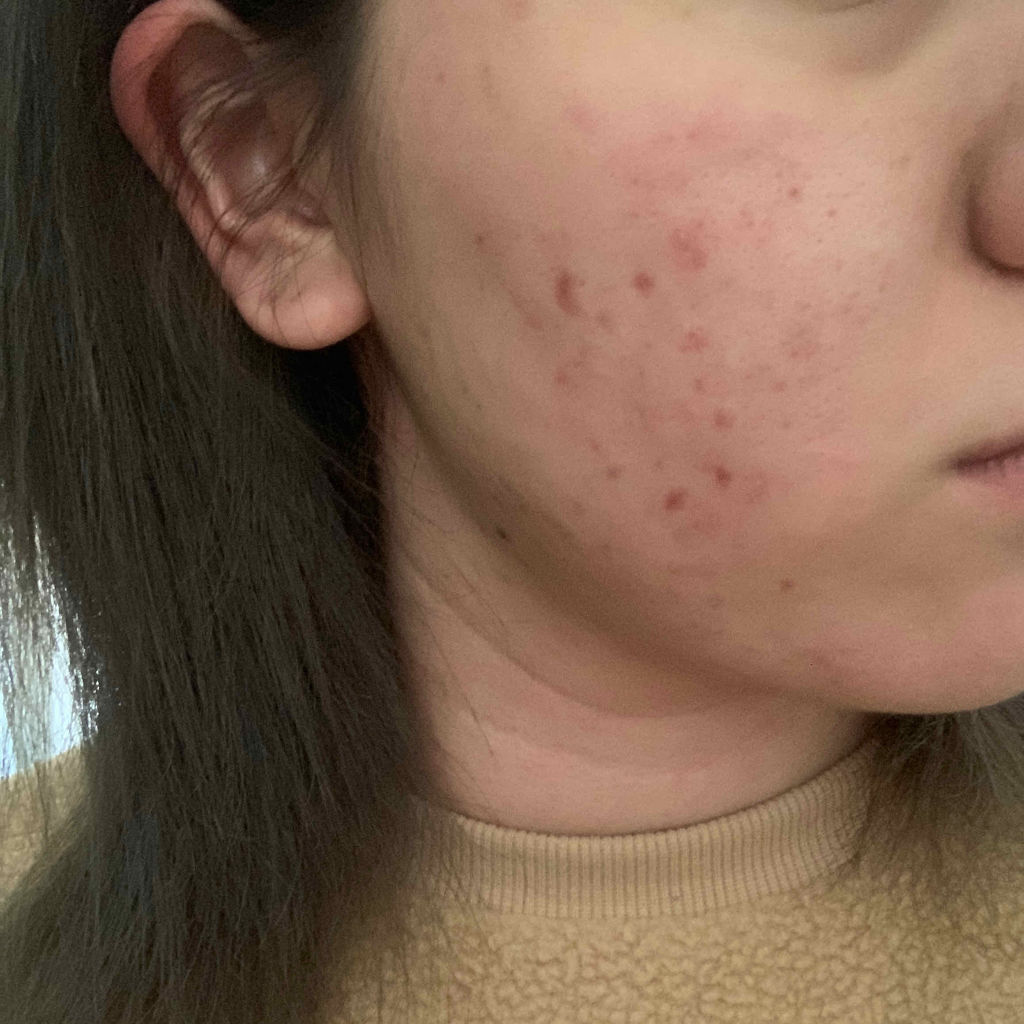 7 day Special Set プログラム3/b.glen/トライアルキットを使ったクチコミ（3枚目）