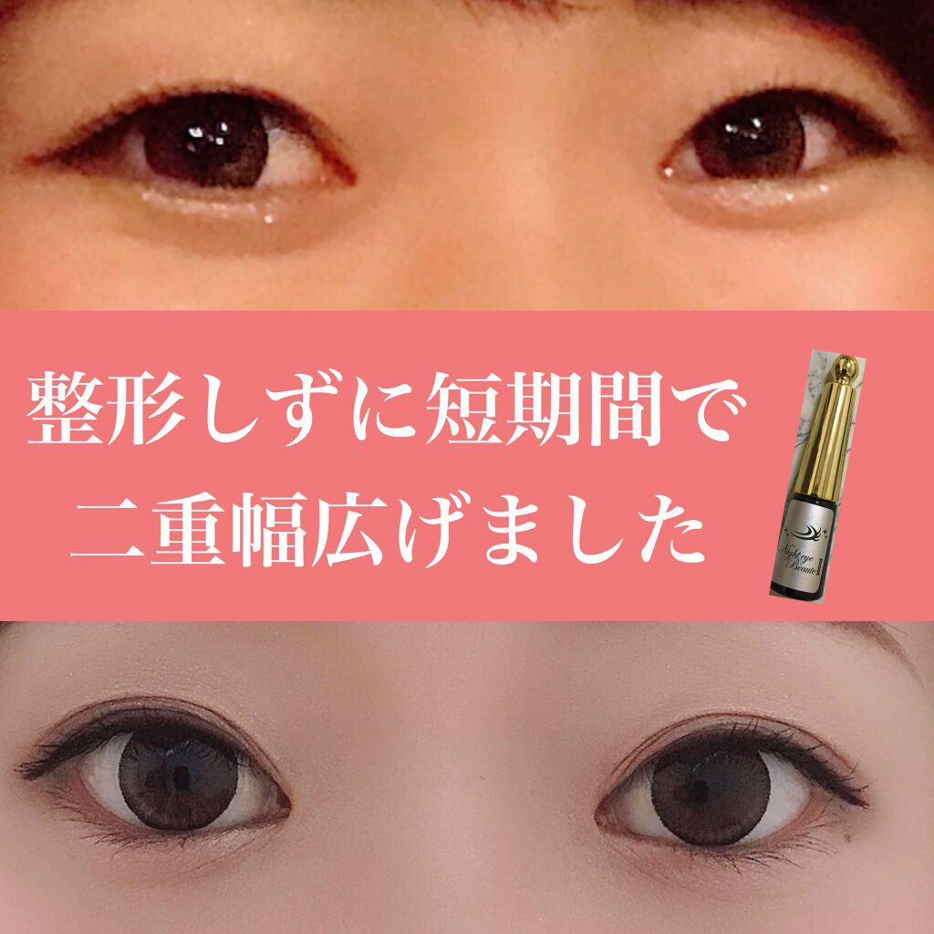 ナイトアイボーテ/StreeTrend/二重まぶた用アイテムを使ったクチコミ(1枚目)
