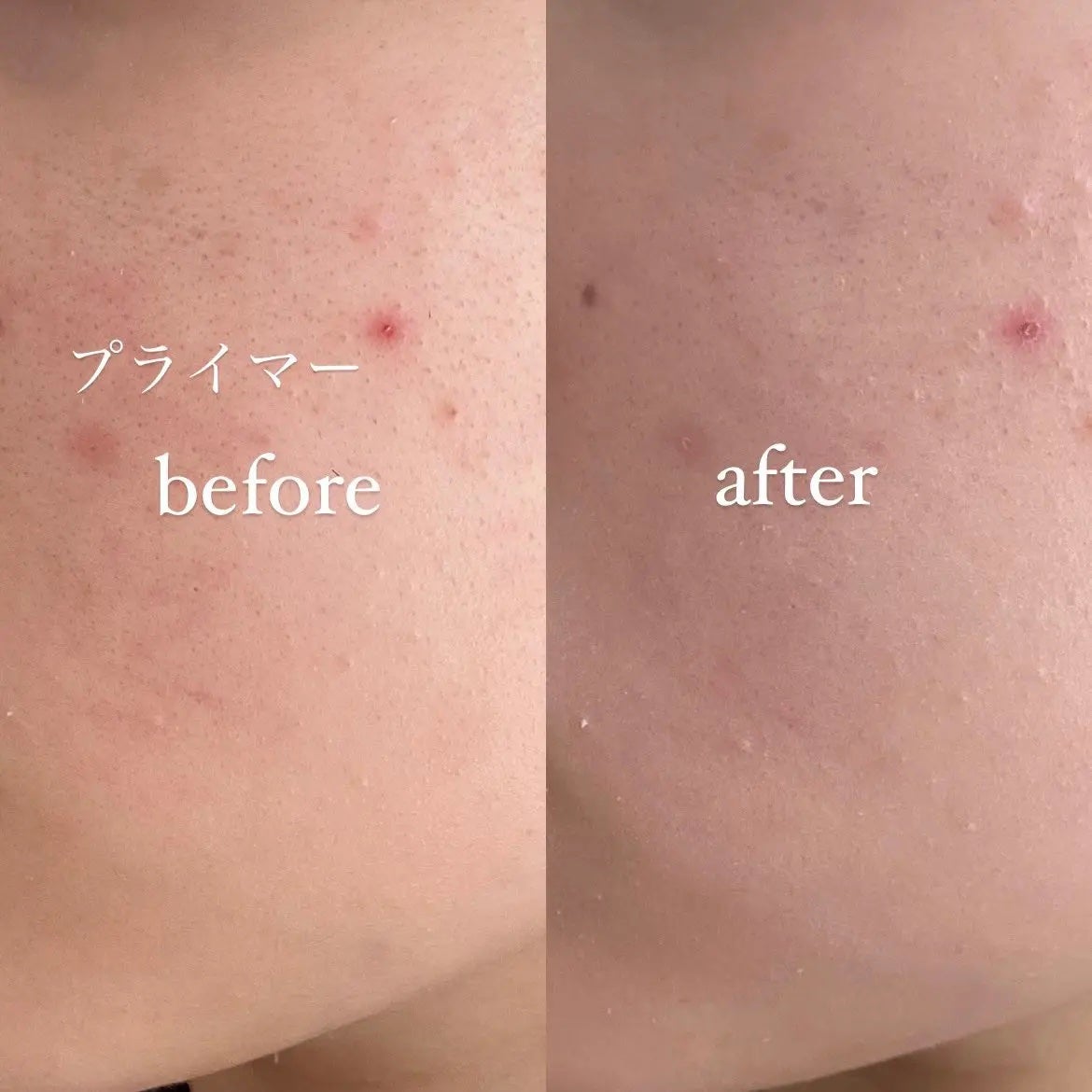 クラウドパウダー/Healus/プレストパウダーを使ったクチコミ(5枚目)