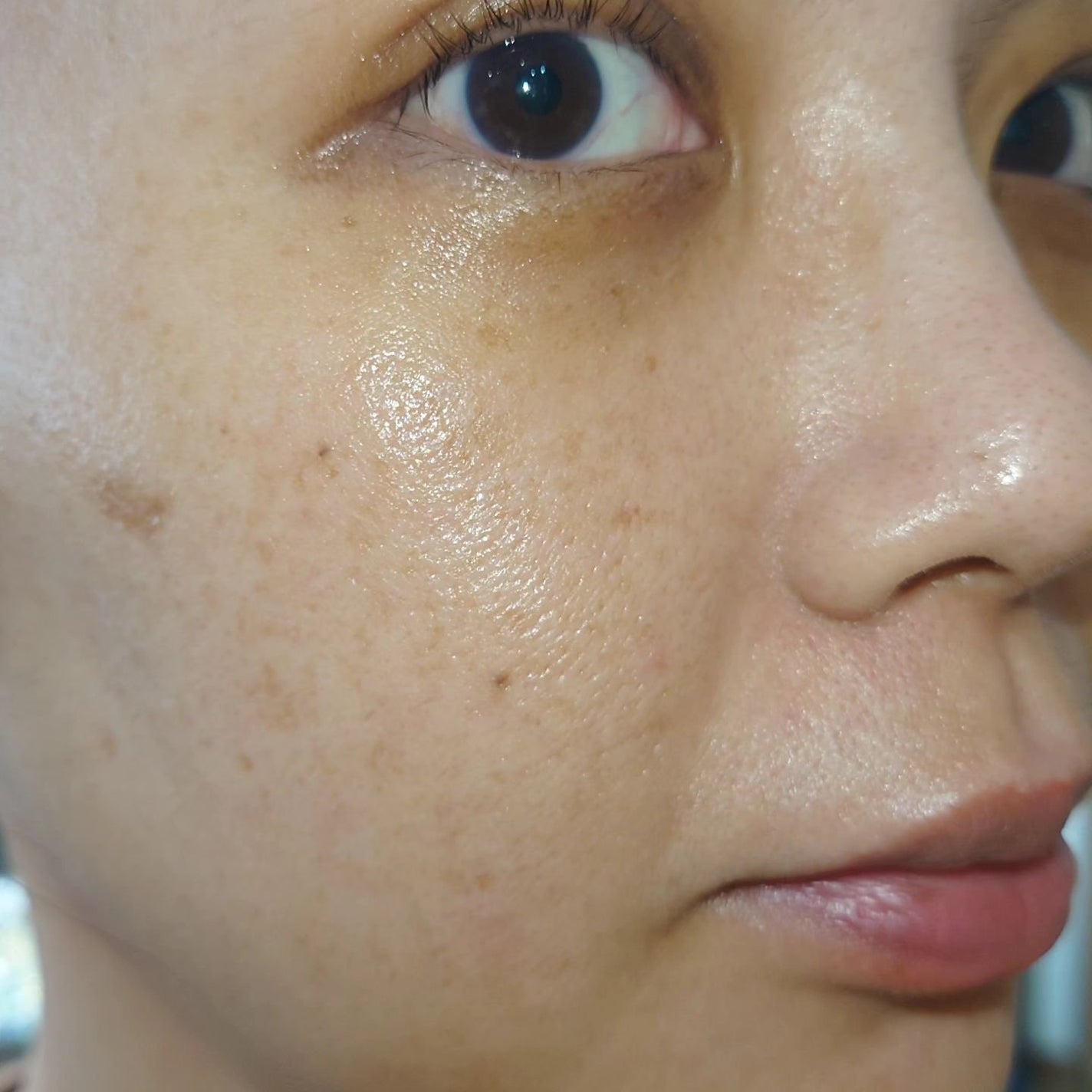 ゼロ毛穴パッド 2.0/MEDICUBE/トナーパッドを使ったクチコミ(8枚目)