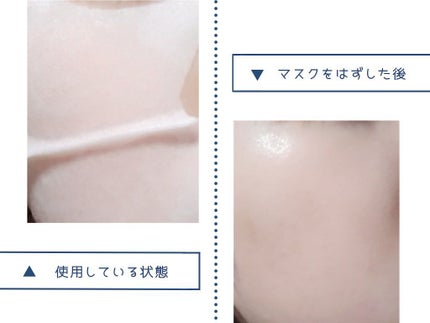 DHC ザ スノーショット シートマスク/DHC/シートマスク・パックを使ったクチコミ(4枚目)