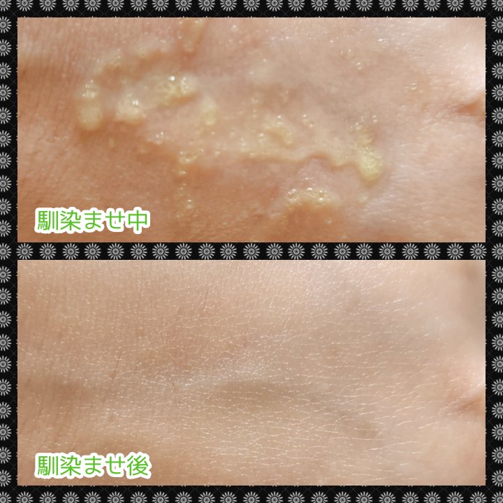 サンデーシカサンセラム/EDIT.B/美容液を使ったクチコミ（3枚目）