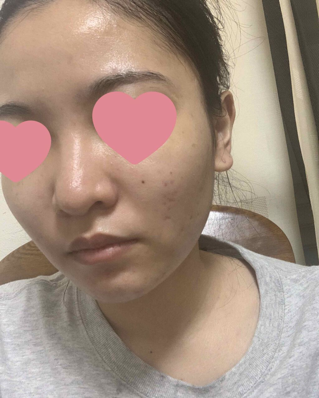 ドクタージャルト シカペア クリーム （第2世代）/Dr.Jart＋/フェイスクリームを使ったクチコミ（3枚目）