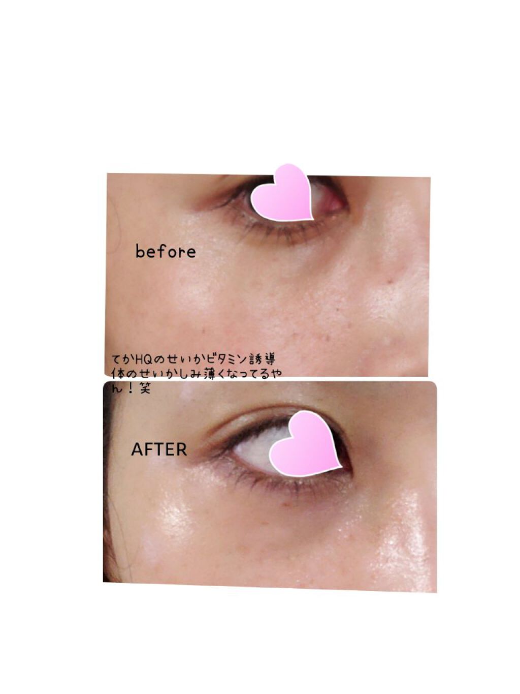 ソフィスタンス インテンシブ/SOPHISTANCE/アイケア・アイクリームを使ったクチコミ（3枚目）