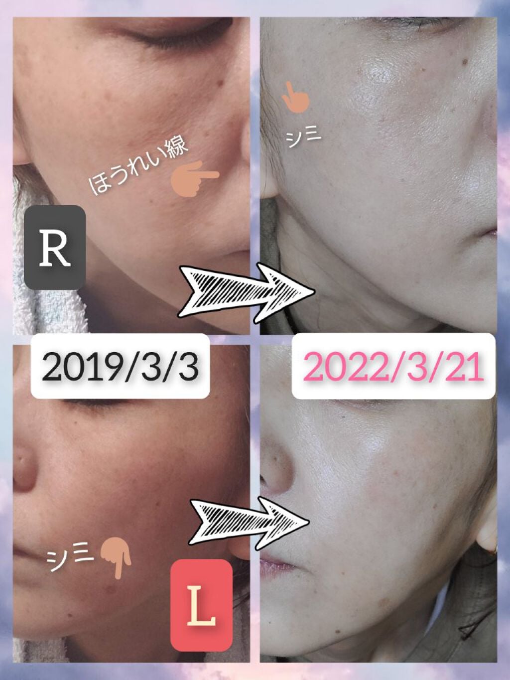 泡の集中パック/ドモホルンリンクル/洗い流すパック・マスクを使ったクチコミ(1枚目)