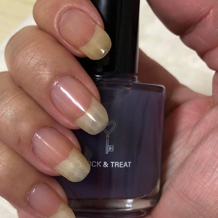 グロスフォーユアネイル/プレビュート/オールインワンネイルを使ったクチコミ(5枚目)