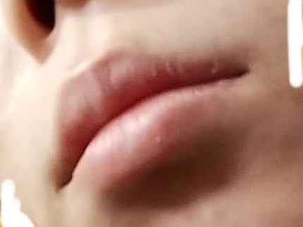 リップパック /CHOOSY/リップマスクを使ったクチコミ(2枚目)