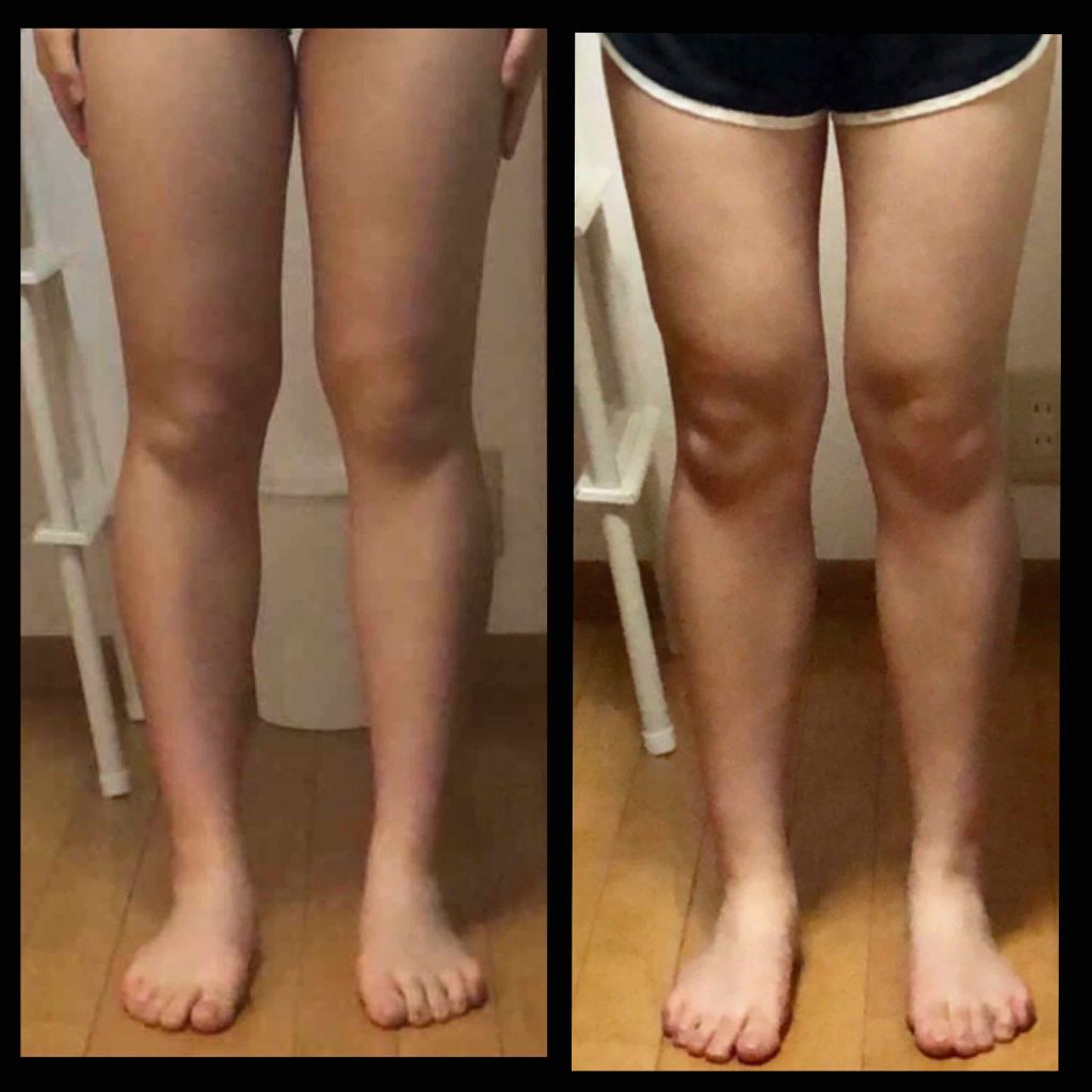 ハトムギボディミルク/麗白/ボディミルクを使ったクチコミ(3枚目)