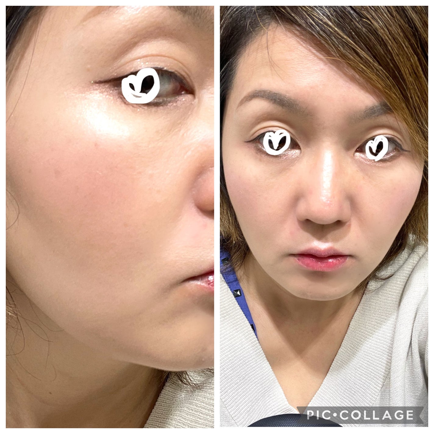 ナチュラル チークN/CEZANNE/パウダーチークを使ったクチコミ(4枚目)