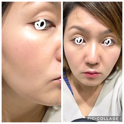 ナチュラル チークN/CEZANNE/パウダーチークを使ったクチコミ(4枚目)