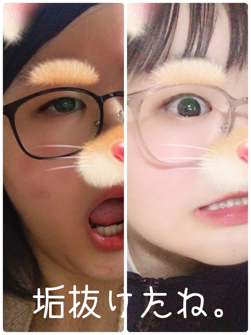 白潤 薬用美白化粧水/肌ラボ/化粧水を使ったクチコミ(5枚目)