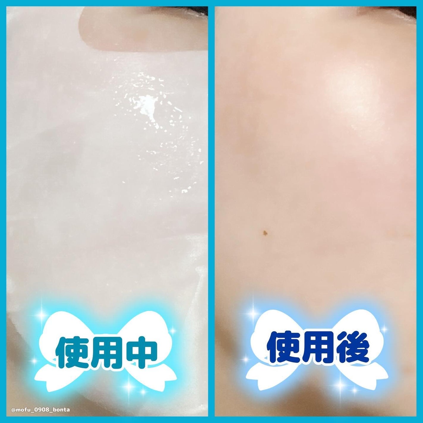 パンテトイン ディープ モイスチャー マスク/manyo/シートマスク・パックを使ったクチコミ(4枚目)