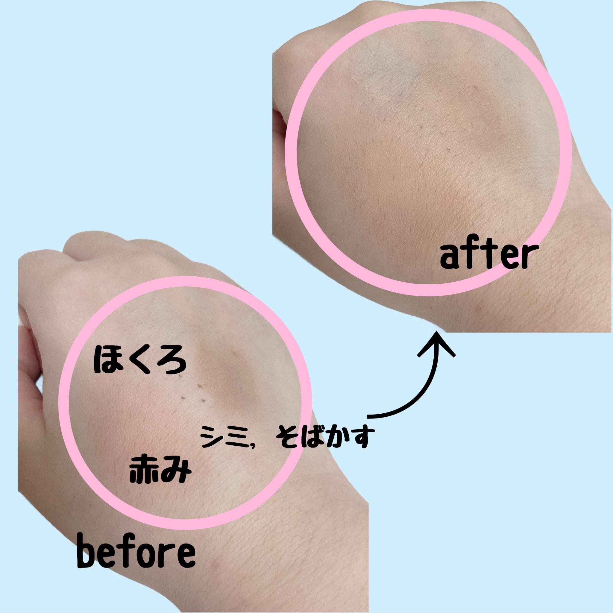 コンシーラー 1 ライト/ちふれ/リキッドコンシーラーを使ったクチコミ（3枚目）