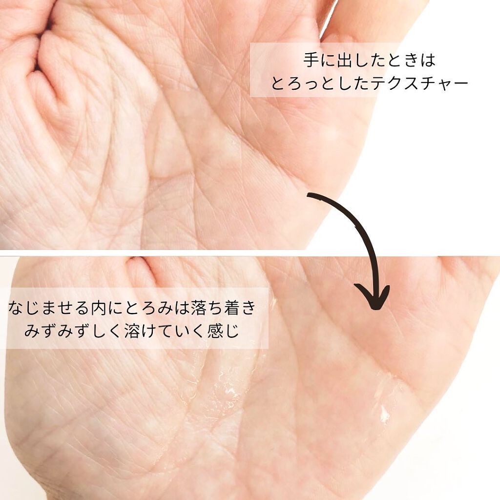 オルビスユー ローション/オルビス/化粧水を使ったクチコミ(3枚目)