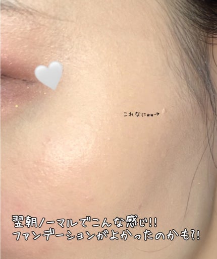 エッセンスマスク/Dermal/シートマスク・パックを使ったクチコミ(2枚目)