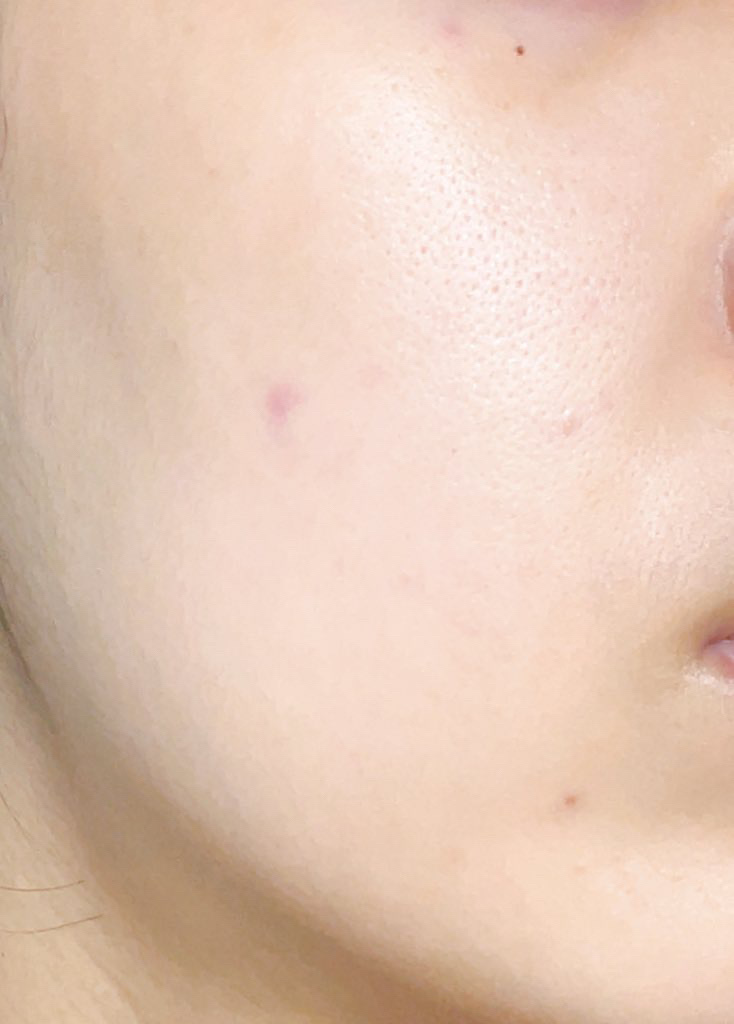 RMK Wトリートメントオイル/RMK/ブースター・導入液を使ったクチコミ（2枚目）