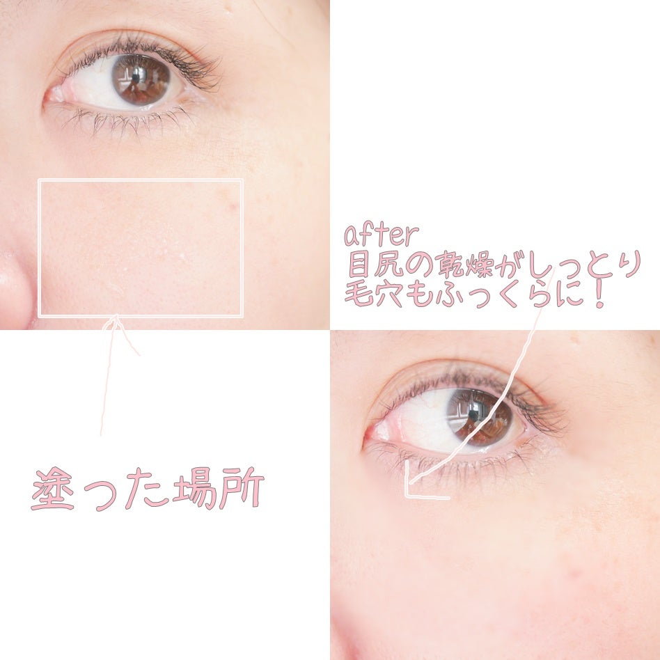 センテラ アンプル/SKIN1004/美容液を使ったクチコミ(5枚目)