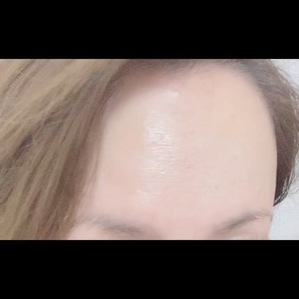 リプレニッシング トリートメント グレード 1/Fillerina/スキンケアキットを使ったクチコミ(6枚目)