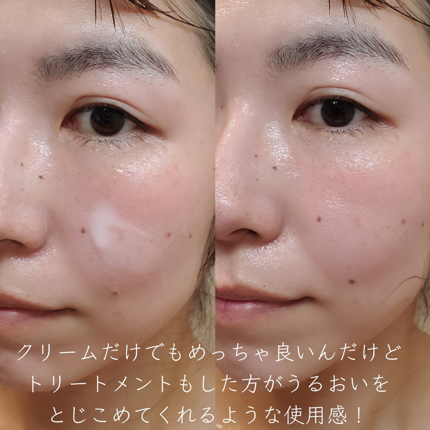 サミュ PHセンシティブフェイシャルトリートメント/SAM'U/美容液を使ったクチコミ(6枚目)