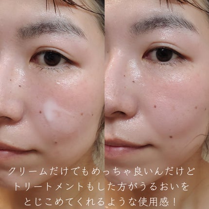 サミュ PHセンシティブフェイシャルトリートメント/SAM'U/美容液を使ったクチコミ(6枚目)