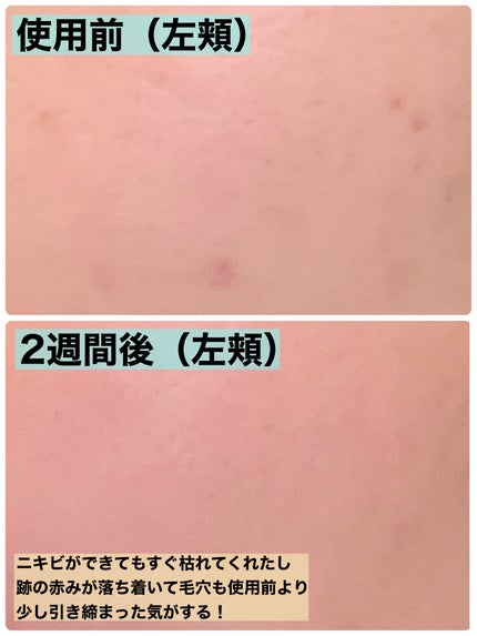 1番 塗るパントテン酸スージングクリーム/numbuzin/フェイスクリームを使ったクチコミ(4枚目)