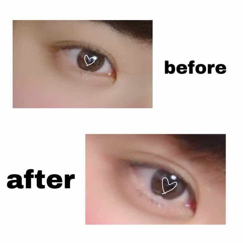 【旧品】オリシキ アイリッドスキンフィルム/D-UP/二重まぶた用アイテムを使ったクチコミ(2枚目)