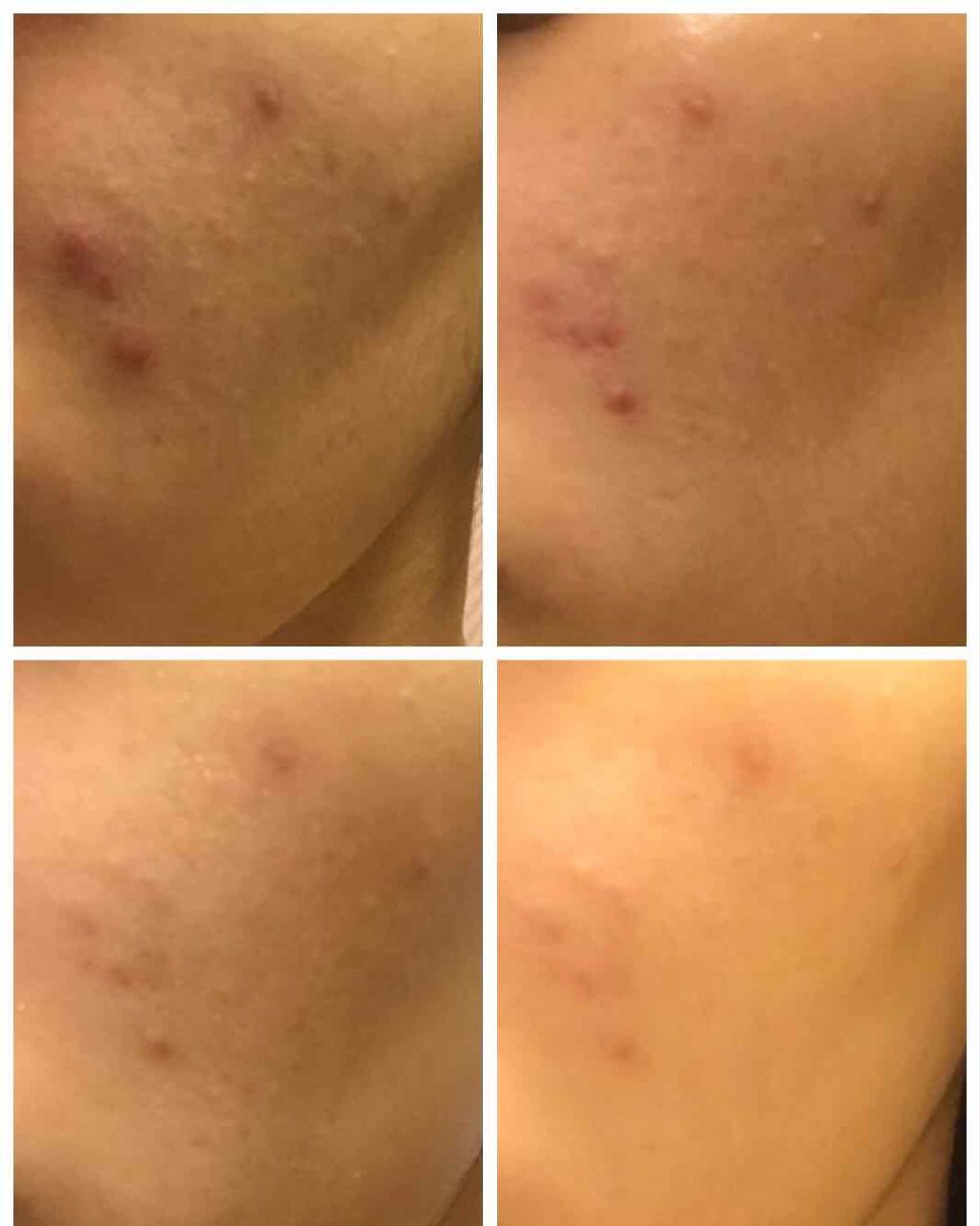 明色美顔水 薬用化粧水/美顔/化粧水を使ったクチコミ（3枚目）