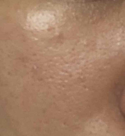 を使ったクチコミ(2枚目)