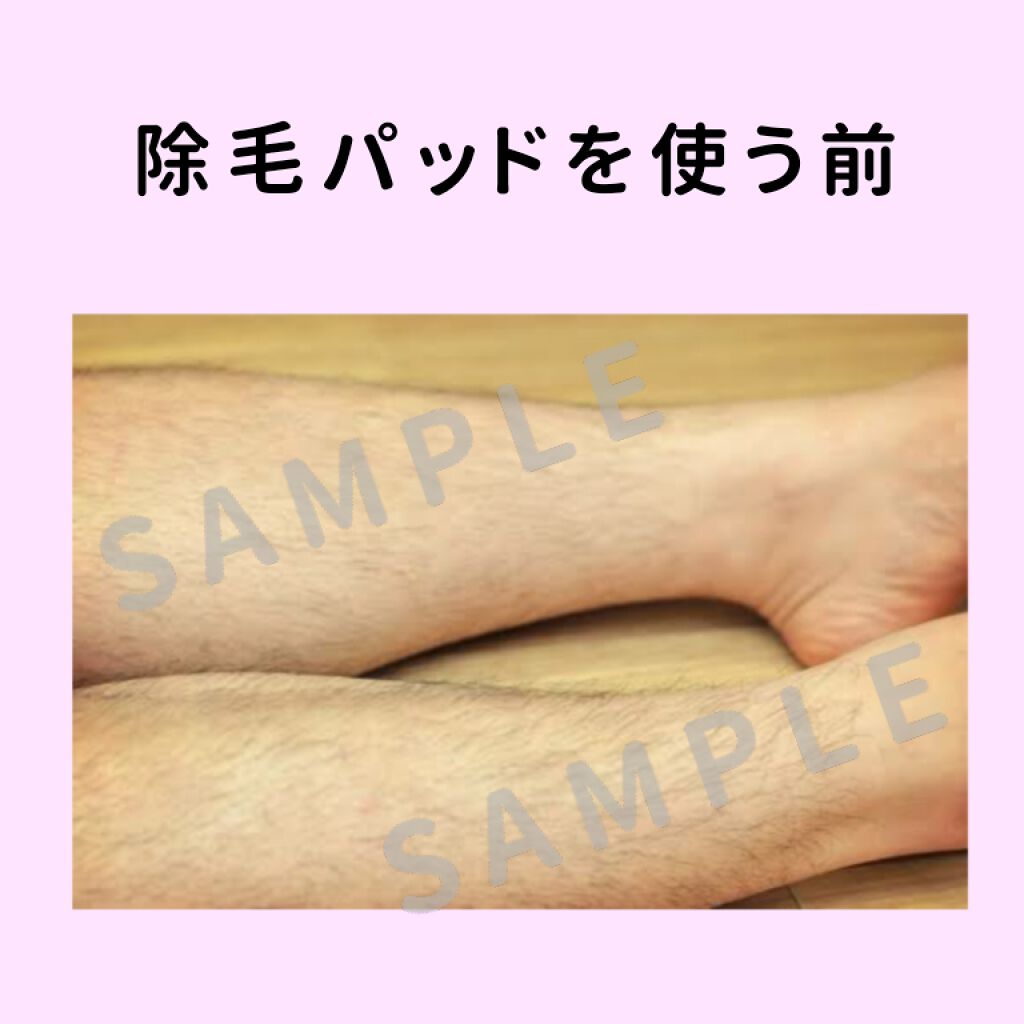 つるすべ除毛パッド/DAISO/ムダ毛ケアを使ったクチコミ（2枚目）