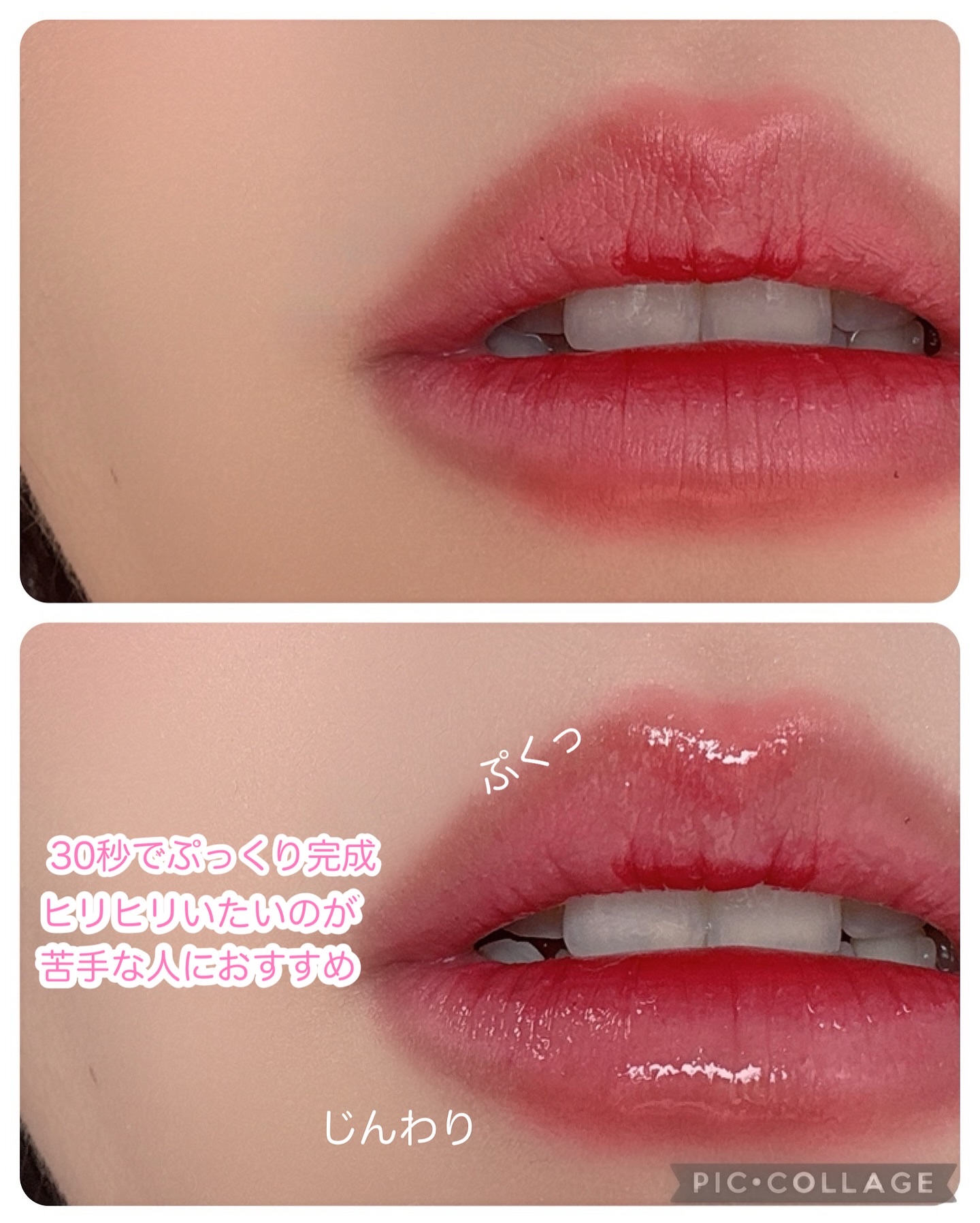 MOOLDA ボリュームマキシマルリッププランパーのクチコミ「Qoo10 2/1-2/8の期間のメガポ何買う？？🐥♡

痛い刺激が苦手だけどプランパーが気に.....」（3枚目）