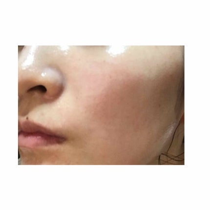 ハトムギ化粧水(ナチュリエ スキンコンディショナー R )/ナチュリエ/化粧水を使ったクチコミ(3枚目)