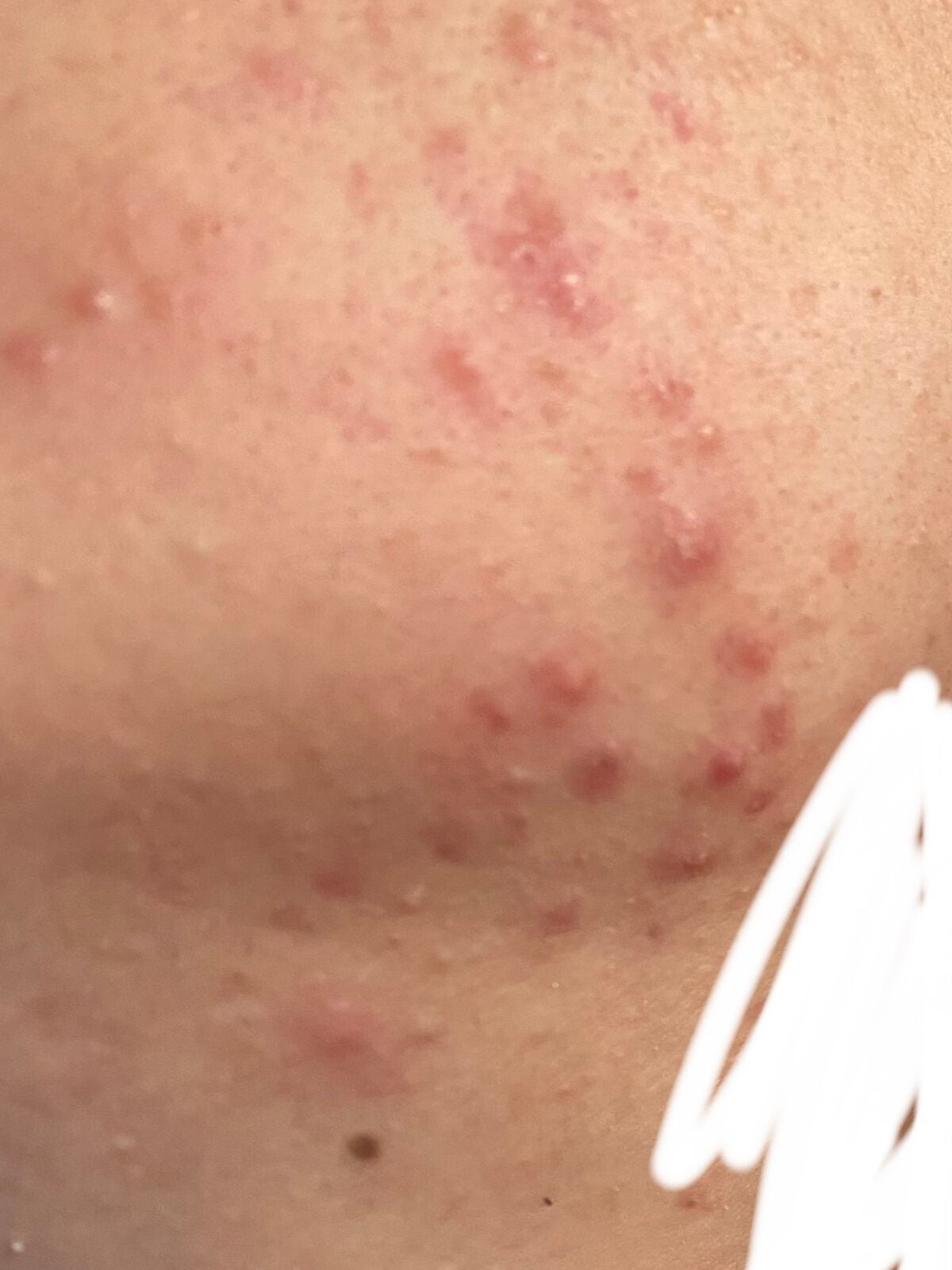 薬用しみ対策 美白化粧水/メラノCC/化粧水を使ったクチコミ(2枚目)