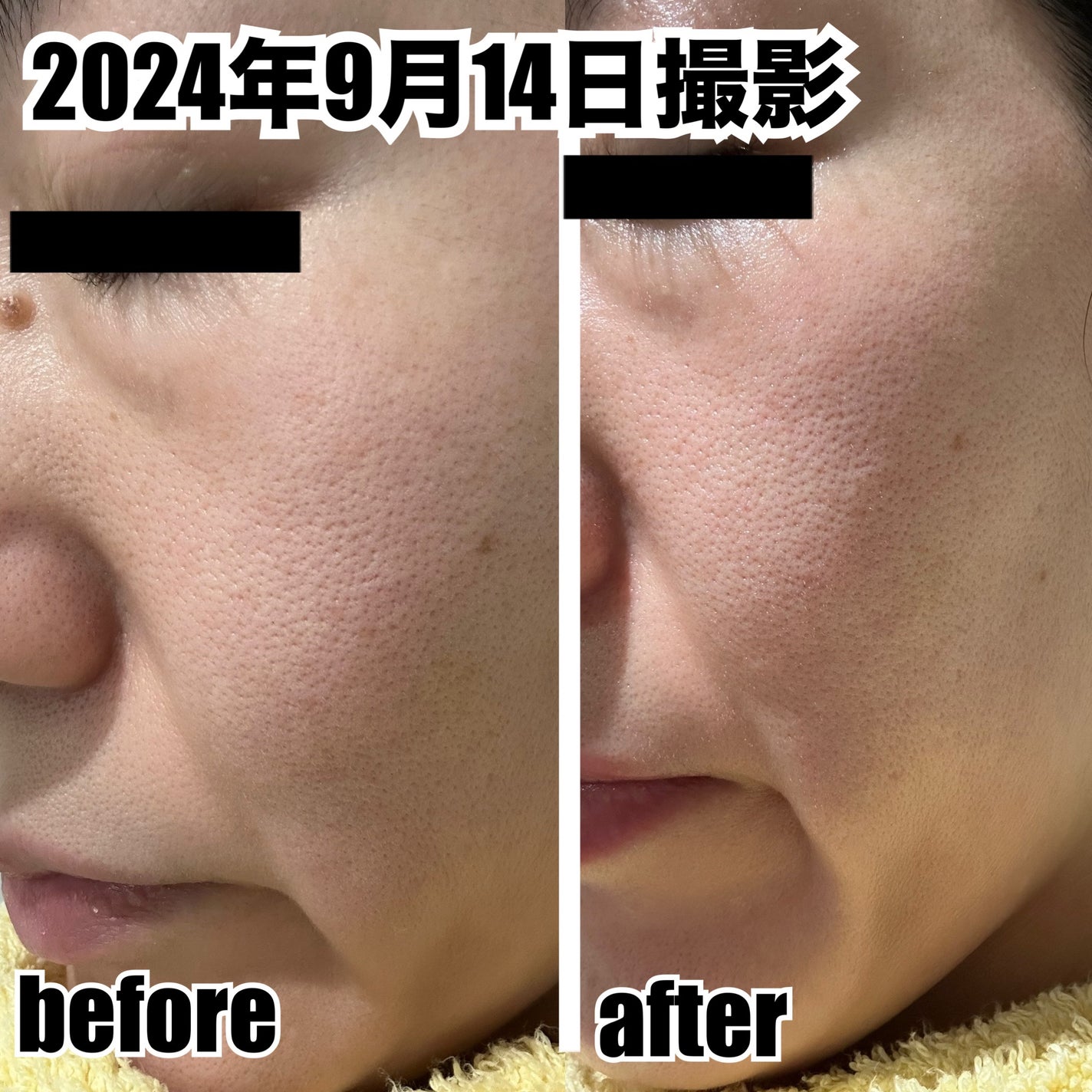 カプチュール トータル ヒアルショット/Dior/美容液を使ったクチコミ(7枚目)