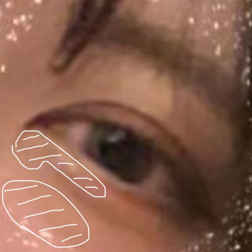 【旧】ディオールスキン フォーエヴァー スキン コレクト コンシーラー/Dior/リキッドコンシーラーを使ったクチコミ（3枚目）