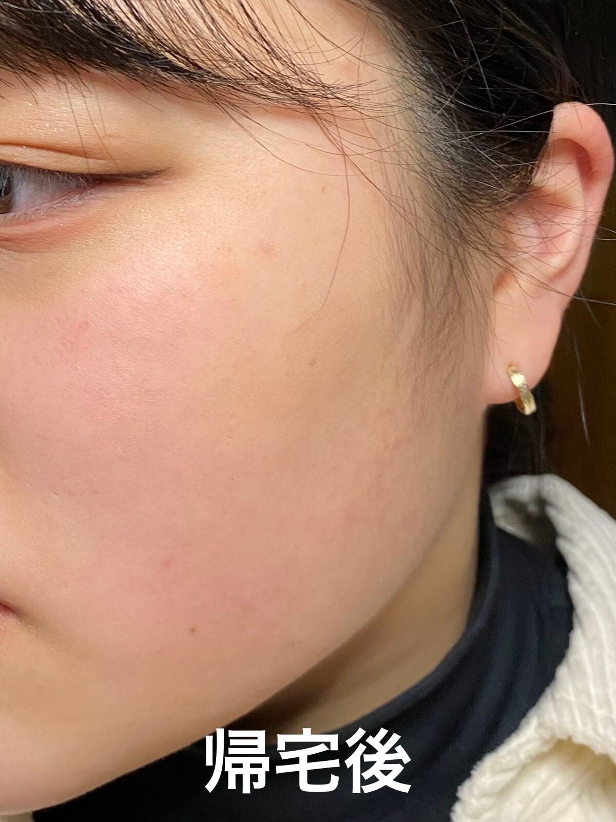 (旧)アンリミテッド ラスティング フルイド/shu uemura/リキッドファンデーションを使ったクチコミ(7枚目)