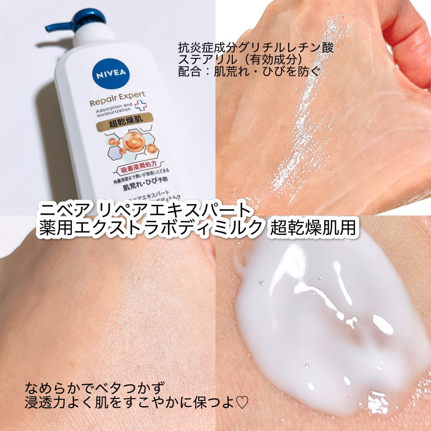 ニベア リペアエキスパート 薬用エクストラボディミルク 超乾燥肌用/ニベア/ボディミルクを使ったクチコミ(2枚目)