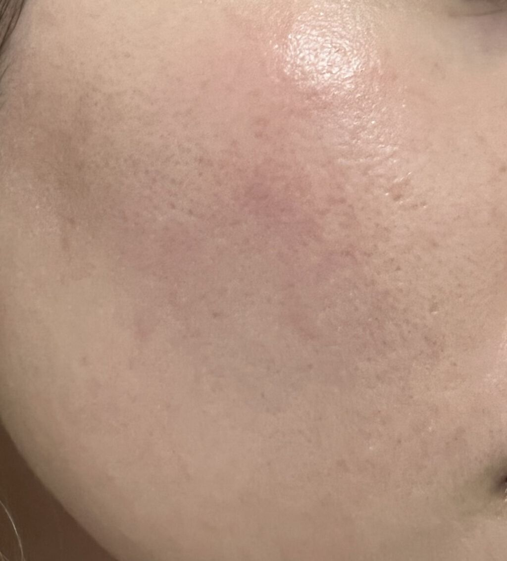 モイストラボ BBエッセンスクリーム/Moist Labo/BBクリームを使ったクチコミ（3枚目）