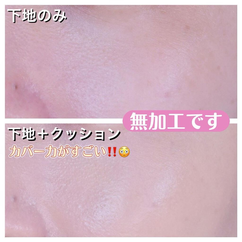 ピンクティーツリートナー/APLIN/化粧水を使ったクチコミ(4枚目)