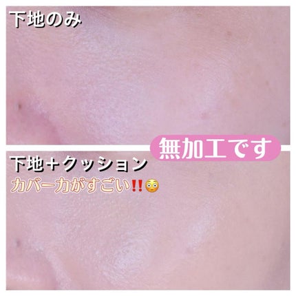 ピンクティーツリートナー/APLIN/化粧水を使ったクチコミ(4枚目)