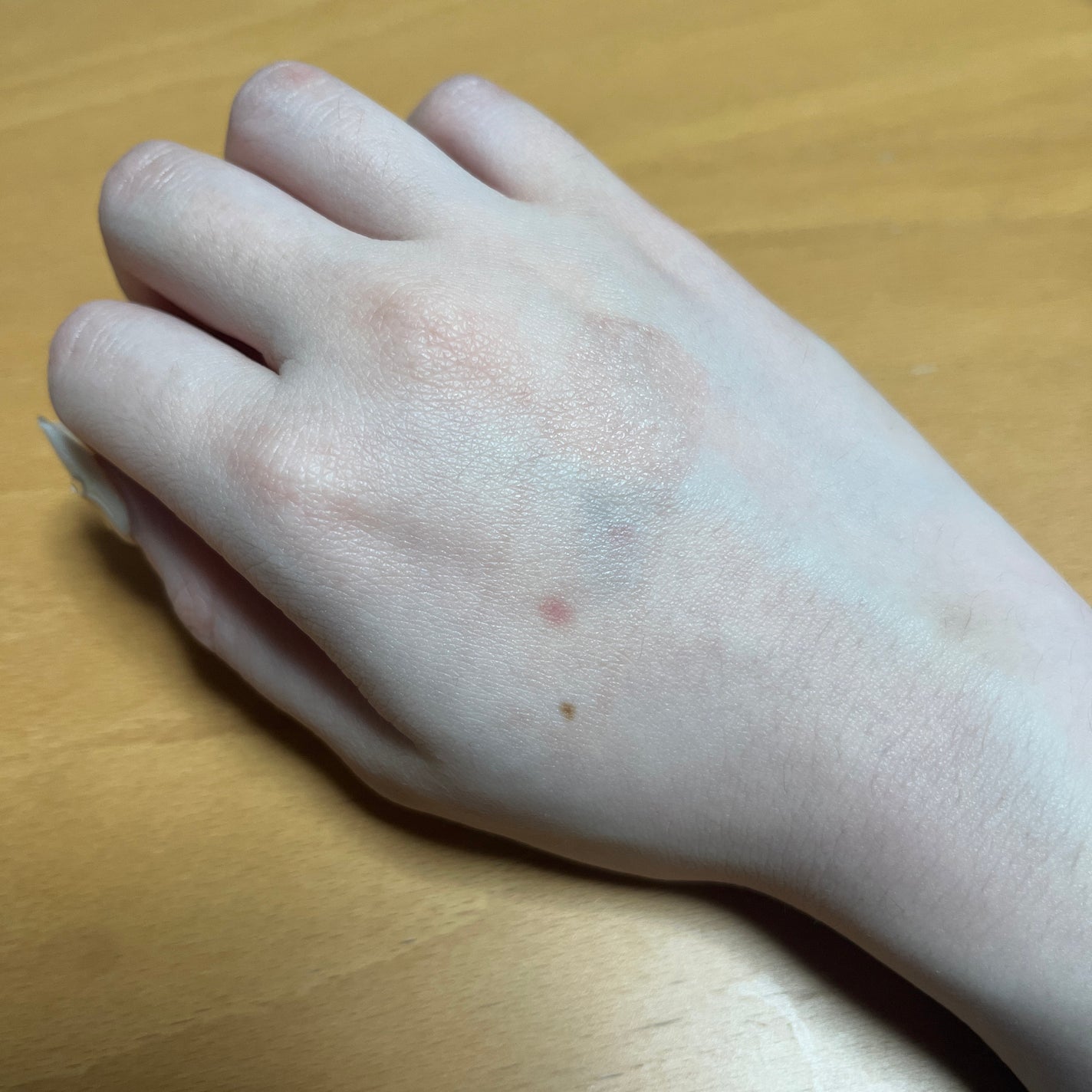 ヘパリンZクリーム(医薬品)/ゼリア新薬工業/その他を使ったクチコミ(3枚目)