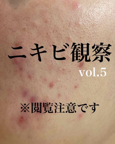 敏感肌用薬用美白美容液/無印良品/美容液を使ったクチコミ（1枚目）