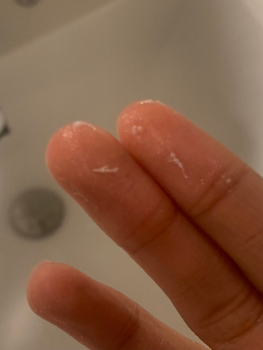 シカルファットプラス リペアクリーム/アベンヌ/フェイスクリームを使ったクチコミ(2枚目)